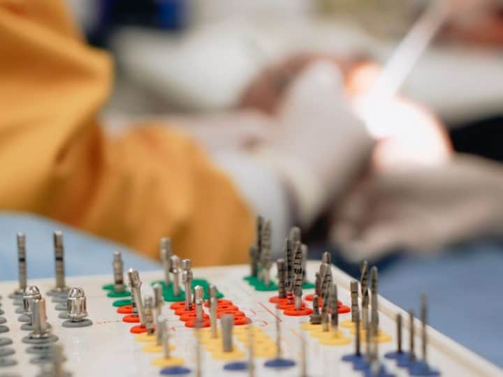 The Guided-Surgery Push Is Changing What Patients Should Ask a Dental Implant Specialist
