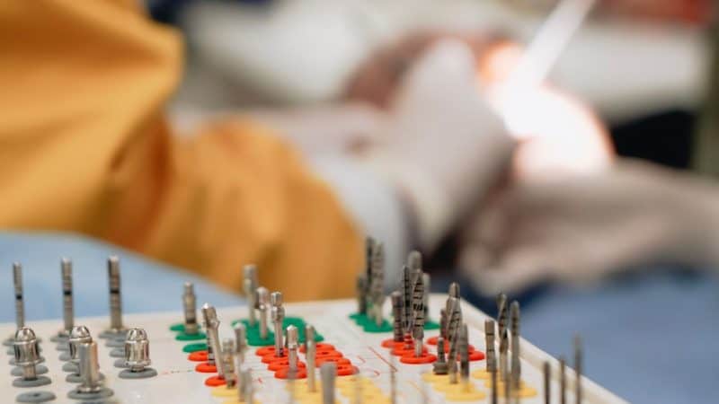 The Guided-Surgery Push Is Changing What Patients Should Ask a Dental Implant Specialist